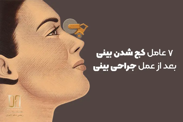 چرا بینی بعد از عمل دوباره کج می‌شود؟ بررسی ۷ علت مهم